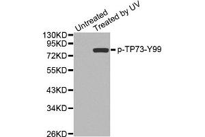 Western Blotting (WB) image for anti-Tumor Protein P73 (TP73) (pTyr99) antibody (ABIN1870690) (Tumor Protein p73 抗体  (pTyr99))