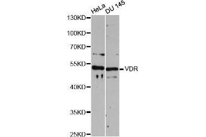 Western blot analysis of extracts of various cell lines, using VDR antibody (ABIN5999166) at 1:3000 dilution. (Vitamin D Receptor 抗体)