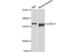 Western blot analysis of extracts of various cell lines, using CARD11 antibody. (CARD11 抗体)