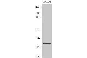 Western Blotting (WB) image for anti-RAB6C (WTH3DI) (Internal Region) antibody (ABIN6281308) (WTH3DI 抗体  (Internal Region))