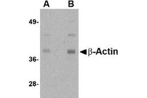 Western Blotting (WB) image for anti-Actin, beta (ACTB) (N-Term) antibody (ABIN1031271) (beta Actin 抗体  (N-Term))