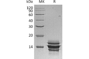 Greater than 95 % as determined by reducing SDS-PAGE. (CXCL7 Protein (His tag))