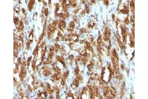 Immunohistochemistry (IHC) image for anti-Actin, alpha 1, Skeletal Muscle (ACTA1) antibody (ABIN3026689)