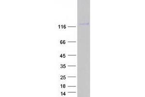 Validation with Western Blot (CD44 Protein (CD44) (Transcript Variant 2) (Myc-DYKDDDDK Tag))