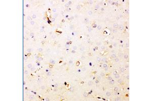 Anti- DHFR Picoband antibody,IHC(P) IHC(P): Rat Brain Tissue (Dihydrofolate Reductase 抗体  (AA 2-187))