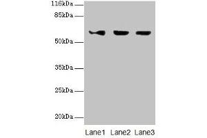 Western blot All lanes: ATL3 antibody at 2 μg/mL Lane 1: Jurkat whole cell lysate Lane 2: Hela whole cell lysate Lane 3: HepG2 whole cell lysate Secondary Goat polyclonal to rabbit IgG at 1/10000 dilution Predicted band size: 61 kDa Observed band size: 61 kDa (ATL3 抗体  (AA 1-187))