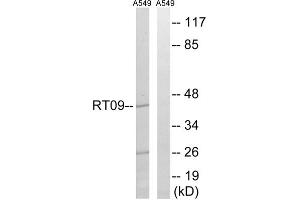 Western blot analysis of extracts from A549 cells, using MRPS9 antibody. (MRPS9 抗体  (Internal Region))