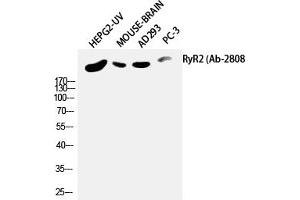 Western Blotting (WB) image for anti-Ryanodine Receptor 2 (Cardiac) (RYR2) (Ser2808) antibody (ABIN5957596) (RYR2 抗体  (Ser2808))