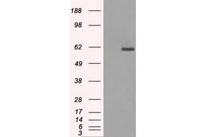 HEK293T cells were transfected with the pCMV6-ENTRY control (Left lane) or pCMV6-ENTRY PPP5C (Right lane) cDNA for 48 hrs and lysed. (PP5 抗体)