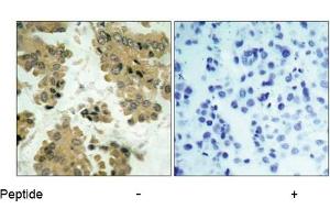 Image no. 1 for anti-V-Akt Murine Thymoma Viral Oncogene Homolog 2 (AKT2) (Ser474) antibody (ABIN197359) (AKT2 抗体  (Ser474))