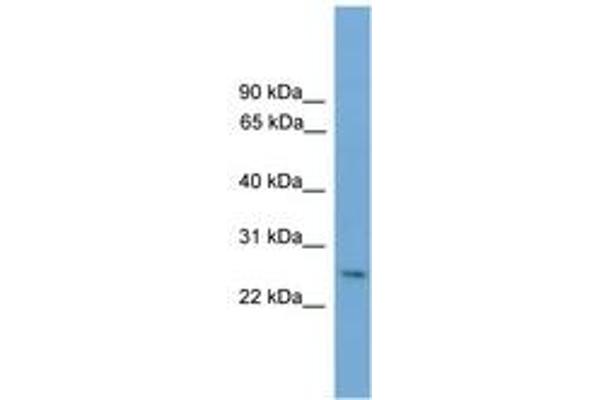 DLX4 抗体  (AA 151-200)