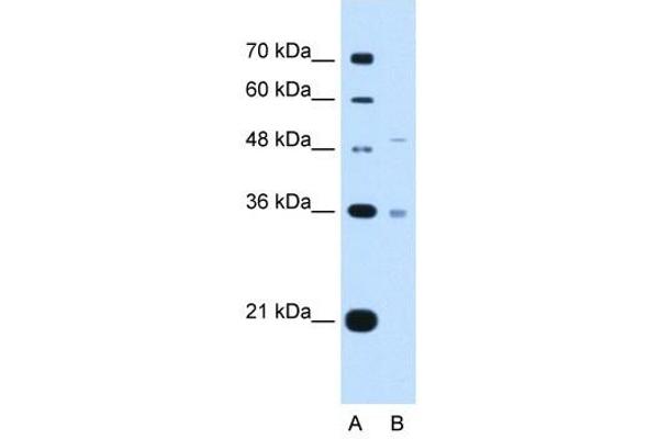 UST 抗体  (C-Term)