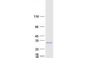 Validation with Western Blot (RHOJ Protein (Myc-DYKDDDDK Tag))