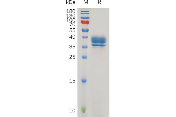 GPR55 Protein (AA 1-21) (Fc Tag)