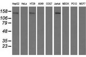 Western blot analysis of extracts (35 µg) from 9 different cell lines by using anti-HDAC6 monoclonal antibody. (HDAC6 抗体)