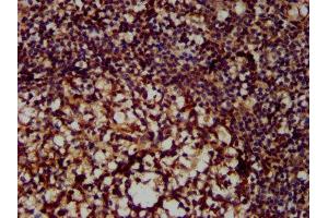 IHC image of ABIN7156645 diluted at 1:300 and staining in paraffin-embedded human tonsil tissue performed on a Leica BondTM system. (MX2 抗体  (AA 548-688))