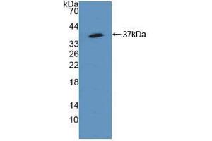 Western blot analysis of recombinant Human SQSTM1. (SQSTM1 抗体  (AA 136-400))