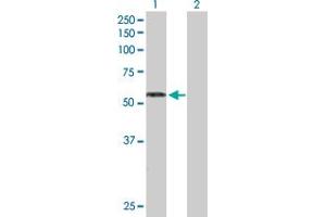 Western Blot analysis of RAG2 expression in transfected 293T cell line by RAG2 MaxPab polyclonal antibody. (RAG2 抗体  (AA 1-527))