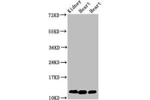 Western Blot Positive WB detected in: Rat kidney tissue, Rat heart tissue, Mouse heart tissue All lanes: CYCS antibody at 2 μg/mL Secondary Goat polyclonal to rabbit IgG at 1/50000 dilution Predicted band size: 12 kDa Observed band size: 12 kDa (Cytochrome C 抗体  (AA 2-105))