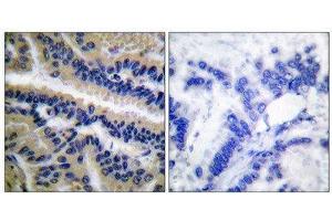 Immunohistochemistry (IHC) image for anti-Caspase 9, Apoptosis-Related Cysteine Peptidase (CASP9) (Cleaved-Asp353) antibody (ABIN1853460) (Caspase 9 抗体  (Cleaved-Asp353))