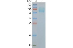 Human A5-Nanodisc, Flag Tag on SDS-PAGE (SLC1A5 蛋白)