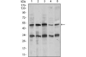 Western blot analysis using CHGA antibody against MOLT4 (1), SK-N-SH (2), HepG2 (3), PC-12 (4), and C6 (5) cell lysate. (Chromogranin A 抗体  (AA 87-252))