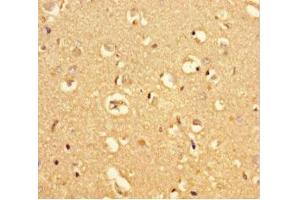 Immunohistochemistry of paraffin-embedded human brain tissue using ABIN7159225 at dilution of 1:100 (MRAP2 抗体  (AA 66-205))