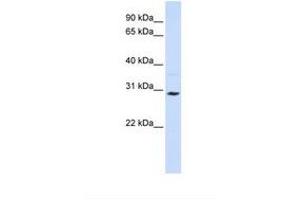 Image no. 1 for anti-Solute Carrier Family 25 (Carnitine/acylcarnitine Translocase), Member 20 (SLC25A20) (AA 216-265) antibody (ABIN6738092) (SLC25A20 抗体  (AA 216-265))