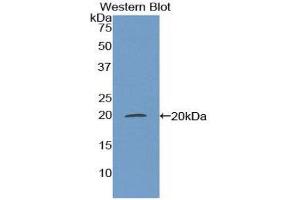 Western Blotting (WB) image for anti-Matrix Gla Protein (MGP) (AA 20-104) antibody (ABIN1174663) (MGP 抗体  (AA 20-104))