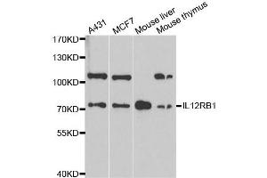 Western Blotting (WB) image for anti-Interleukin 12 Receptor beta 1 (IL12RB1) antibody (ABIN1980210) (IL12RB1 抗体)