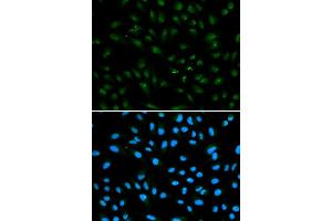 Immunofluorescence (IF) image for anti-Androgen Receptor (AR) antibody (ABIN1871059)