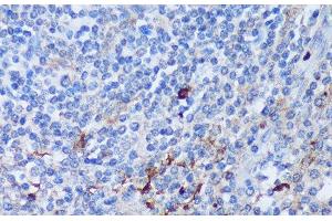 Immunohistochemistry of paraffin-embedded Human tonsil using PADI4 Polyclonal Antibody at dilution of 1:100 (40x lens). (PAD4 抗体)