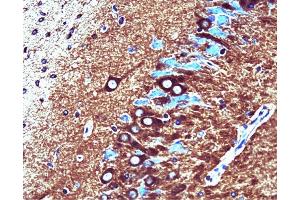 Catalytic alpha (clone 46) staining on rat brain. (PP2A Catalytic alpha (AA 153-309) 抗体)