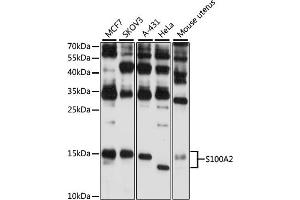 Western blot analysis of extracts of various cell lines, using S100 antibody (ABIN6128692, ABIN6147343, ABIN6147344 and ABIN6216356) at 1:3000 dilution. (S100A2 抗体  (AA 1-97))