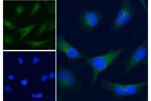 IF/ICC staining of human HeLa cells with Alexa Fluor 488 secondary, and GAPDH antibody at 5ug/ml (blue = DAPI nuclear counterstain). (GAPDH 抗体)
