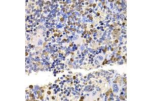 Immunohistochemistry of paraffin-embedded rat spleen using UBE2V2 antibody. (UBE2V2 抗体  (AA 1-145))