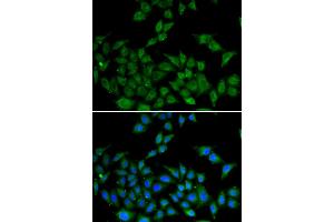 Immunofluorescence analysis of HeLa cells using DIDO1 antibody (ABIN5973852). (DIDO1 抗体)