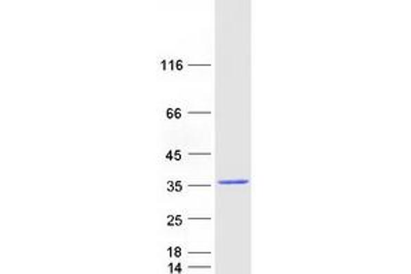 RAB9B Protein (Myc-DYKDDDDK Tag)