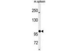 Western Blotting (WB) image for anti-UDP-N-Acetyl-alpha-D-Galactosamine:polypeptide N-Acetylgalactosaminyltransferase 5 (GalNAc-T5) (GALNT5) antibody (ABIN3004405) (GALNT5 抗体)