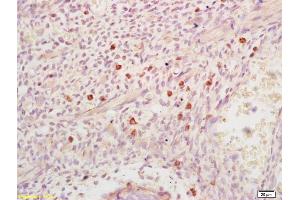 Formalin-fixed and paraffin embedded mouse embryo labeled with Anti-DHFR Polyclonal Antibody, Unconjugated (ABIN1387277) at 1:200 followed by conjugation to the secondary antibody and DAB staining (Dihydrofolate Reductase 抗体)