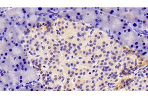 Detection of XRN1 in Rat Pancreas Tissue using Polyclonal Antibody to 5'-3'Exoribonuclease 1 (XRN1) (XRN1 抗体  (AA 1567-1723))