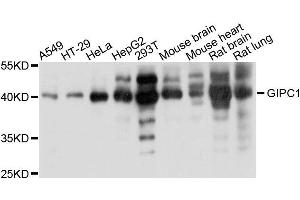 Western blot analysis of extracts of various cells, using GIPC1 antibody. (GIPC1 抗体)