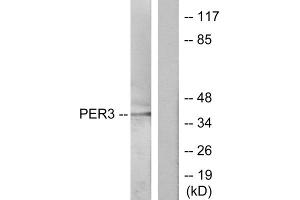 Western blot analysis of extracts from Jurkat cells, treated with insulin (0. (PER3 抗体  (N-Term))