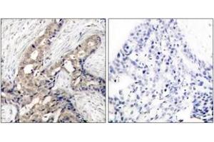 Immunohistochemistry (IHC) image for anti-C-Abl Oncogene 1, Non-Receptor tyrosine Kinase (ABL1) (pTyr393) antibody (ABIN2888351) (ABL1 抗体  (pTyr393))