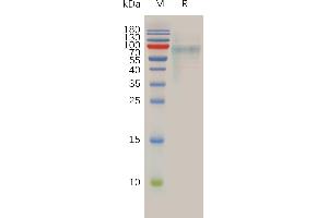 Human LIV-1 Protein, His Tag on SDS-PAGE under reducing condition. (SLC39A6 Protein (AA 29-325) (His tag))