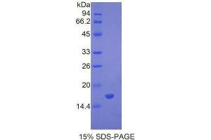 SDS-PAGE analysis of Mouse BMP7 Protein. (BMP7 蛋白)