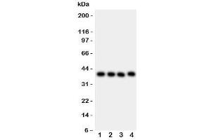 Western blot testing of CD34 antibody and Lane 1:  MCF-7;  2: MM231;  3: SMMC-7721;  4: HepG2 lysate. (CD34 抗体  (AA 151-385))
