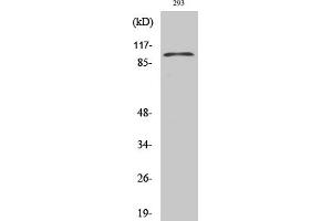 Western Blot analysis of 293 cells using E-cadherin Polyclonal Antibody diluted at 1:1000. (E-cadherin 抗体  (AA 1-80))