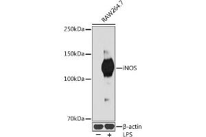 Western blot analysis of extracts of R. (NOS2 抗体)