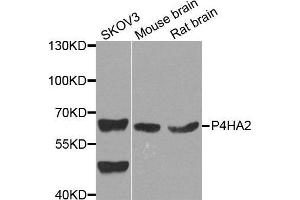 Western Blotting (WB) image for anti-Prolyl 4-Hydroxylase, alpha Polypeptide II (P4HA2) (AA 234-533) antibody (ABIN6220566) (P4HA2 抗体  (AA 234-533))